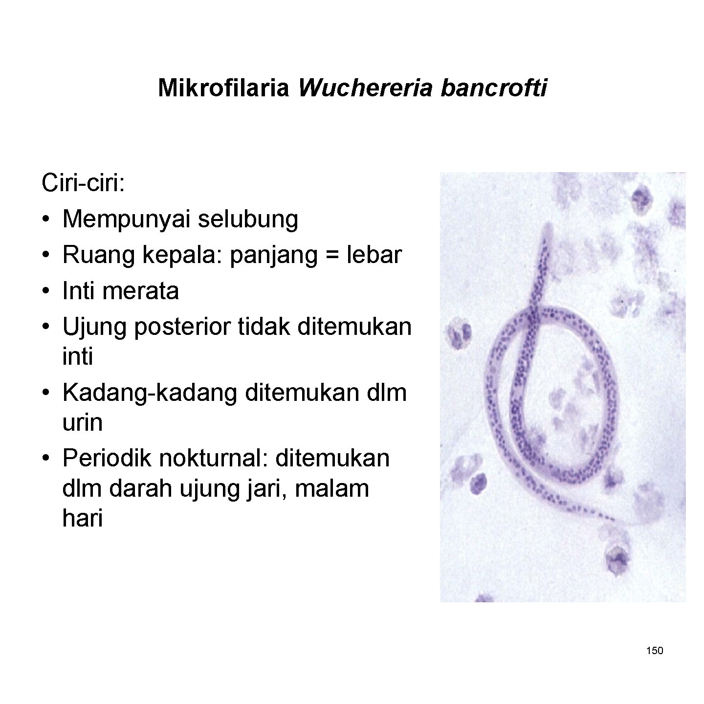 Mikrofilaria Wuchereria bancrofti Ciri-ciri: • Mempunyai selubung • Ruang kepala: panjang = lebar •