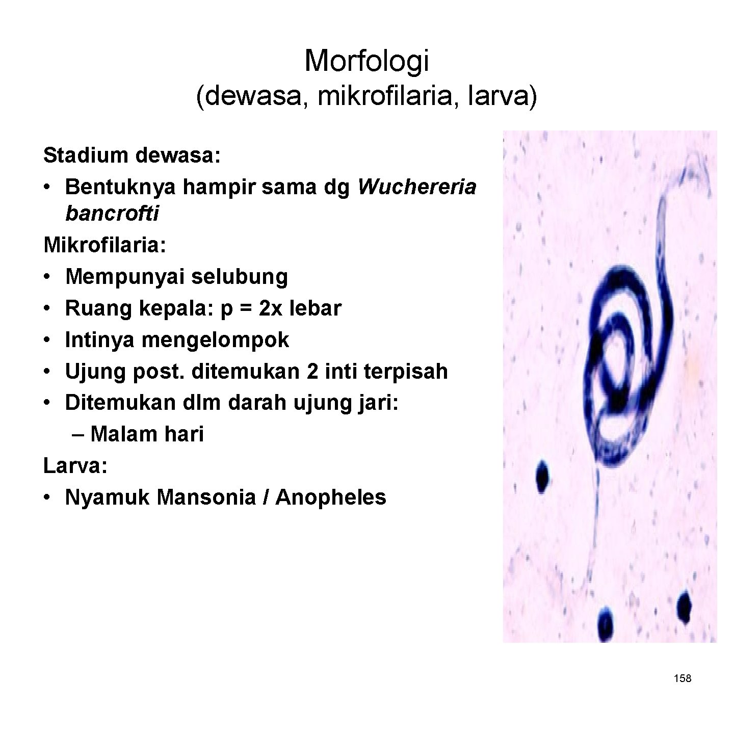 Morfologi (dewasa, mikrofilaria, larva) Stadium dewasa: • Bentuknya hampir sama dg Wuchereria bancrofti Mikrofilaria: