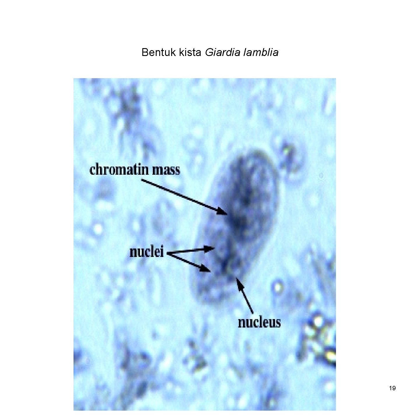 Bentuk kista Giardia lamblia 19 