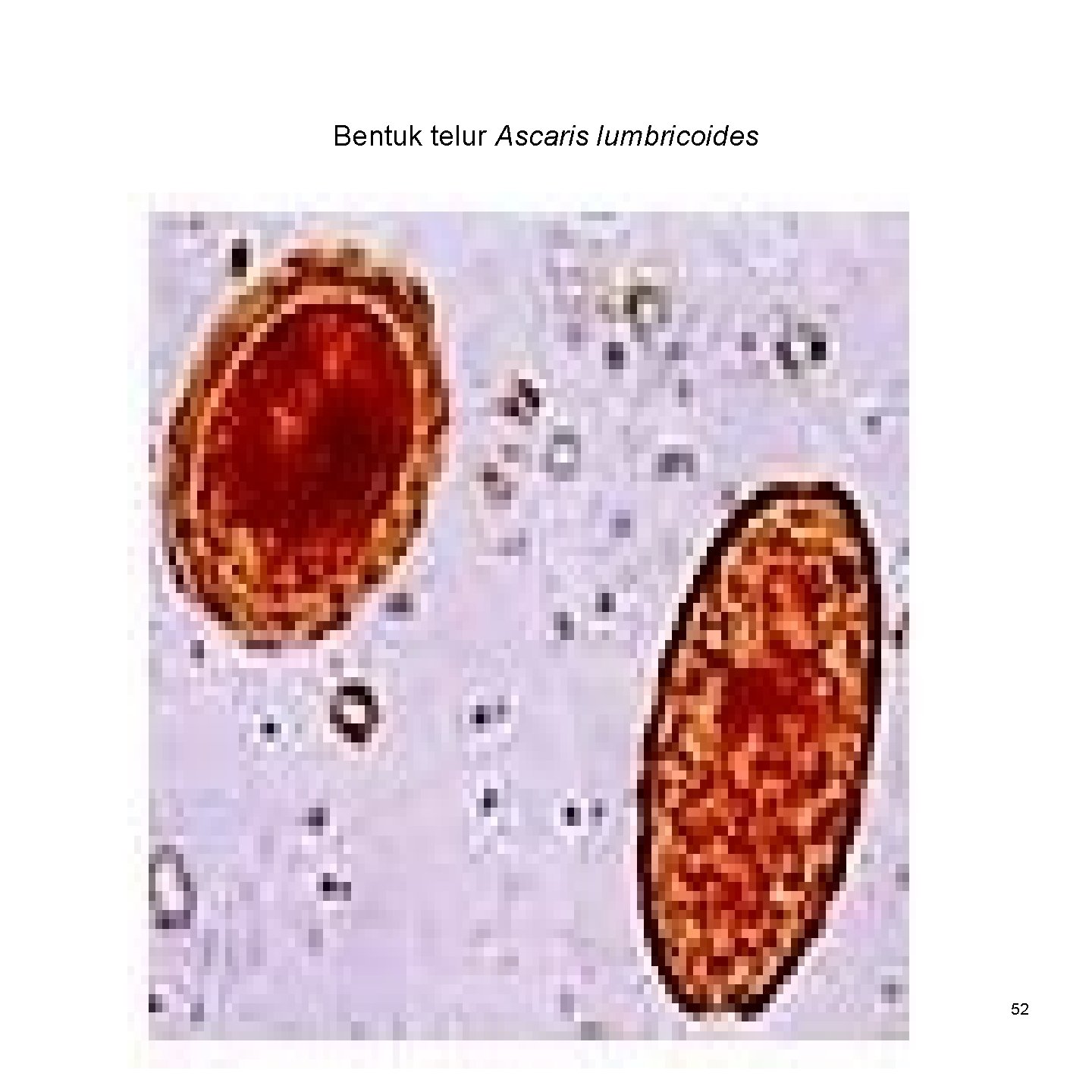 Bentuk telur Ascaris lumbricoides 52 