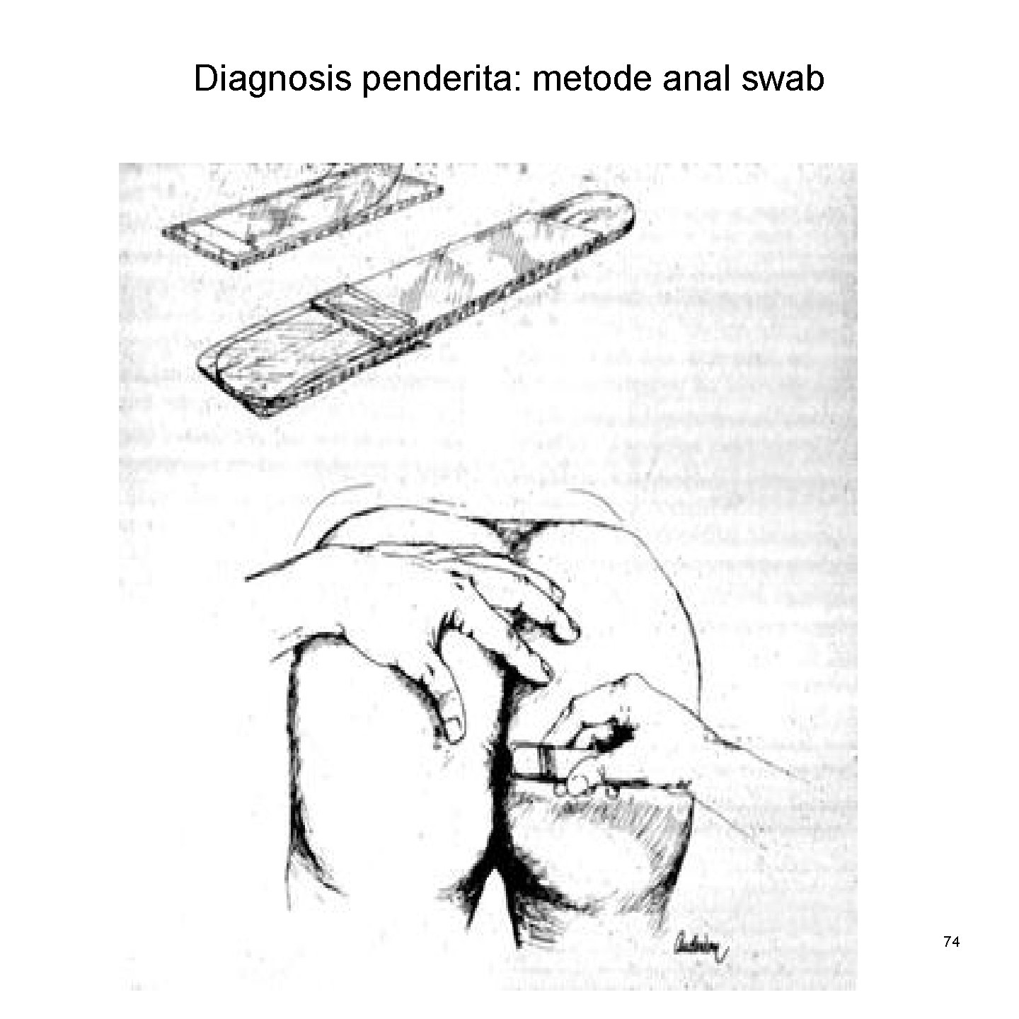 Diagnosis penderita: metode anal swab 74 