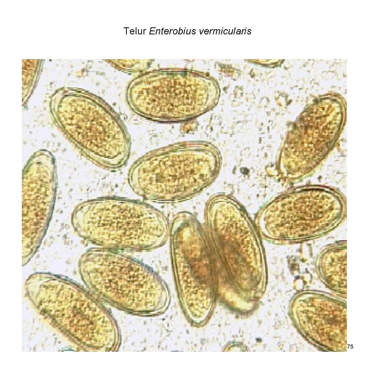 Telur Enterobius vermicularis 75 