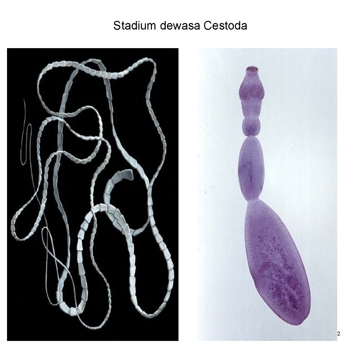 Stadium dewasa Cestoda 82 