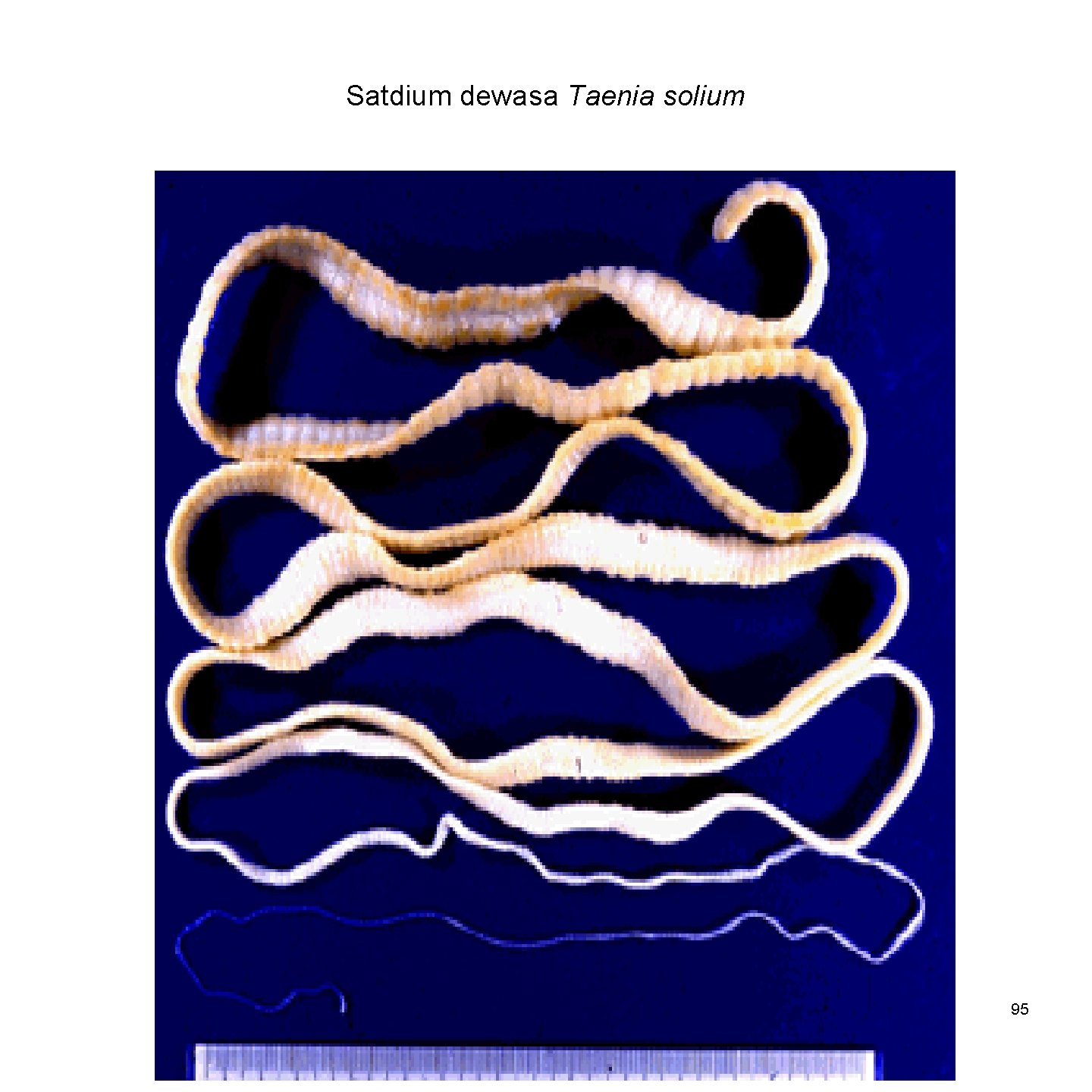 Satdium dewasa Taenia solium 95 