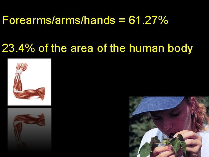 Forearms/hands = 61. 27% 23. 4% of the area of the human body 