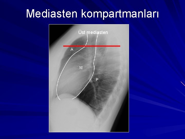 Mediasten kompartmanları Üst mediasten 