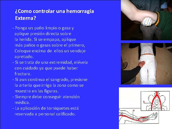 ¿Como controlar una hemorragia Externa? - Ponga un paño limpio o gasa y aplique