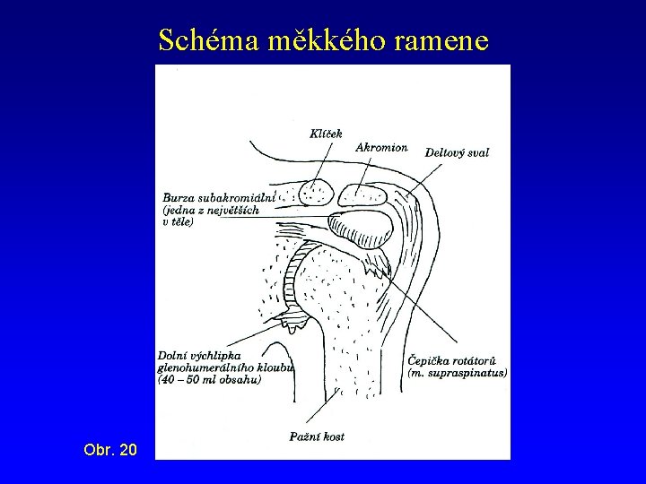 Schéma měkkého ramene Obr. 20 