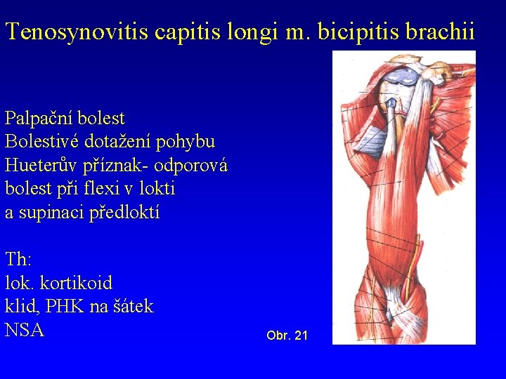 Tenosynovitis capitis longi m. bicipitis brachii Palpační bolest Bolestivé dotažení pohybu Hueterův příznak- odporová