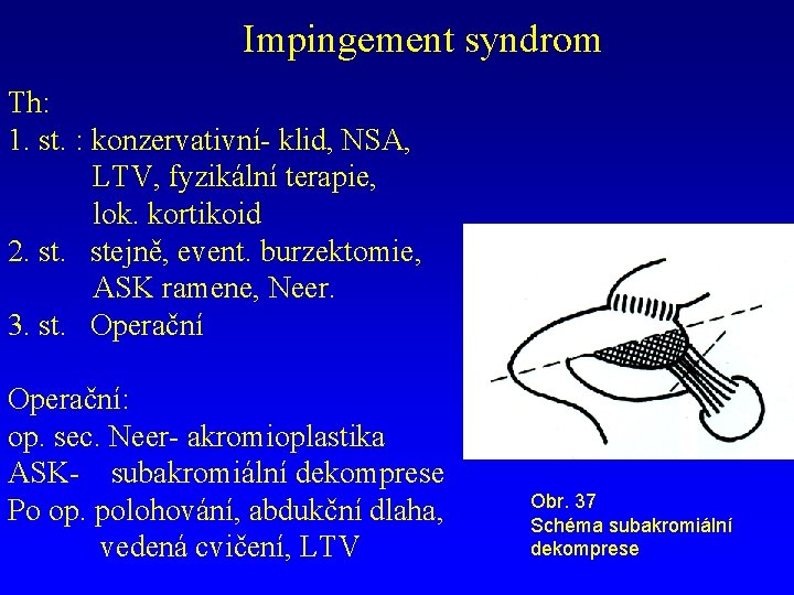 Impingement syndrom Th: 1. st. : konzervativní- klid, NSA, LTV, fyzikální terapie, lok. kortikoid