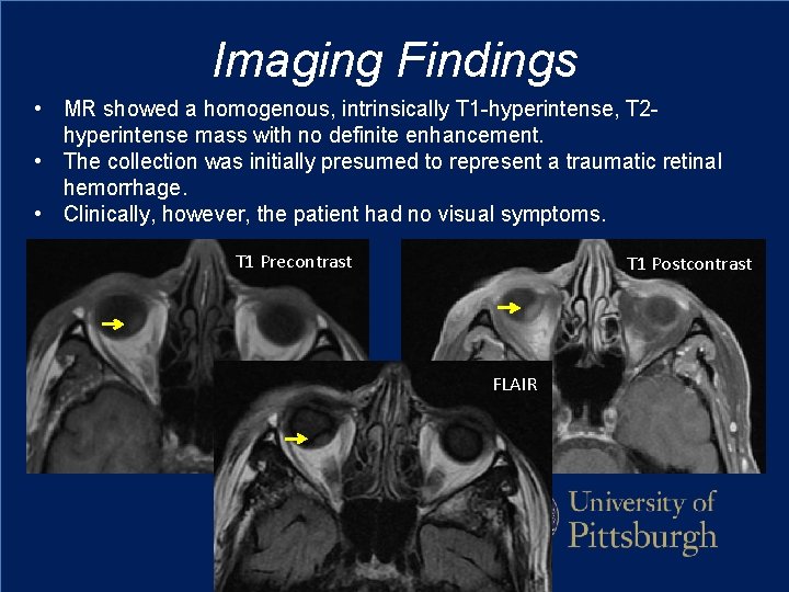 Imaging Findings • MR showed a homogenous, intrinsically T 1 -hyperintense, T 2 hyperintense