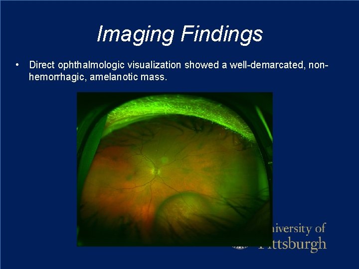 Imaging Findings • Direct ophthalmologic visualization showed a well-demarcated, nonhemorrhagic, amelanotic mass. 