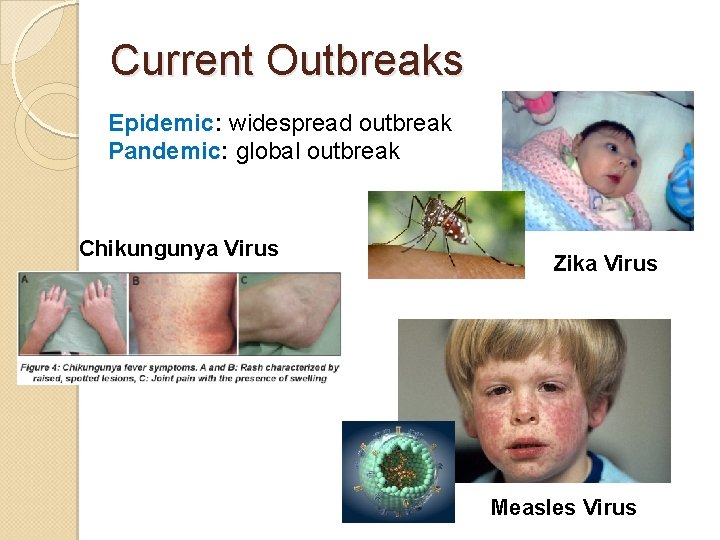 Current Outbreaks Epidemic: widespread outbreak Pandemic: global outbreak Chikungunya Virus Zika Virus Measles Virus