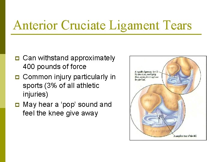 Anterior Cruciate Ligament Tears p p p Can withstand approximately 400 pounds of force