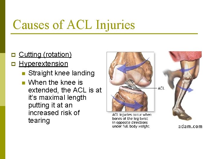 Causes of ACL Injuries p p Cutting (rotation) Hyperextension n Straight knee landing n