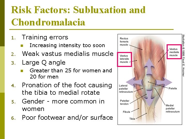 Risk Factors: Subluxation and Chondromalacia 1. Training errors n 2. 3. Weak vastus medialis