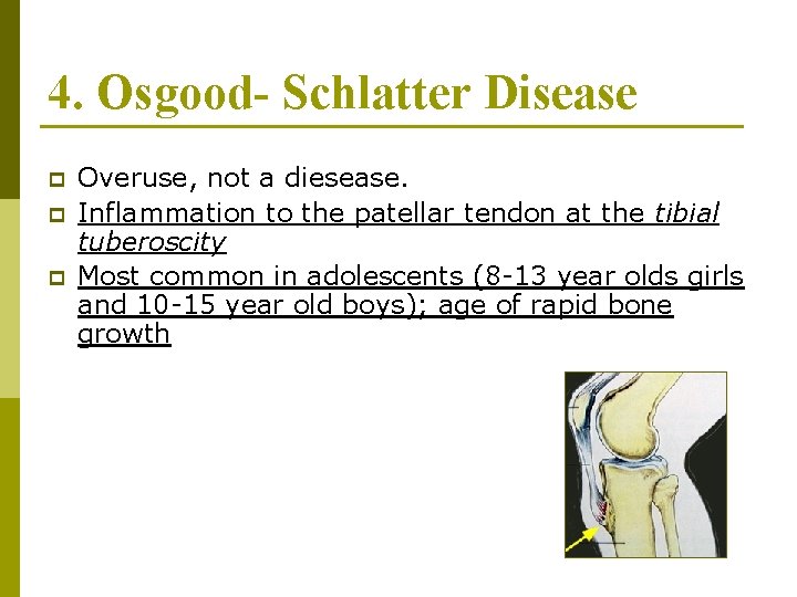 4. Osgood- Schlatter Disease p p p Overuse, not a diesease. Inflammation to the