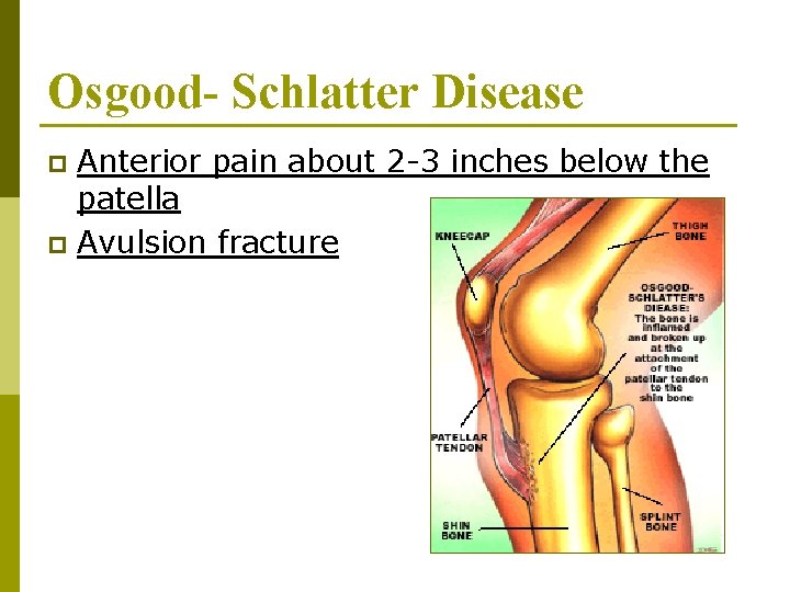 Osgood- Schlatter Disease Anterior pain about 2 -3 inches below the patella p Avulsion