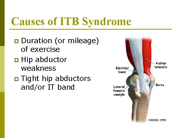 Causes of ITB Syndrome Duration (or mileage) of exercise p Hip abductor weakness p