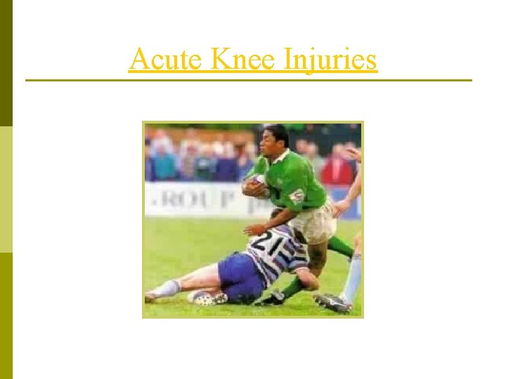 Acute Knee Injuries 