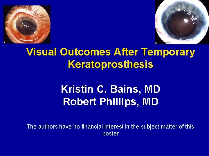 Visual Outcomes After Temporary Keratoprosthesis Kristin C. Bains, MD Robert Phillips, MD The authors