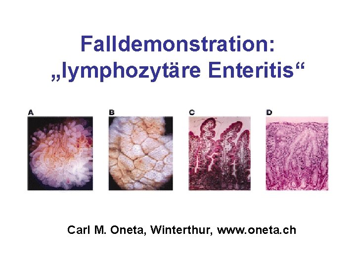 Falldemonstration: „lymphozytäre Enteritis“ Carl M. Oneta, Winterthur, www. oneta. ch 