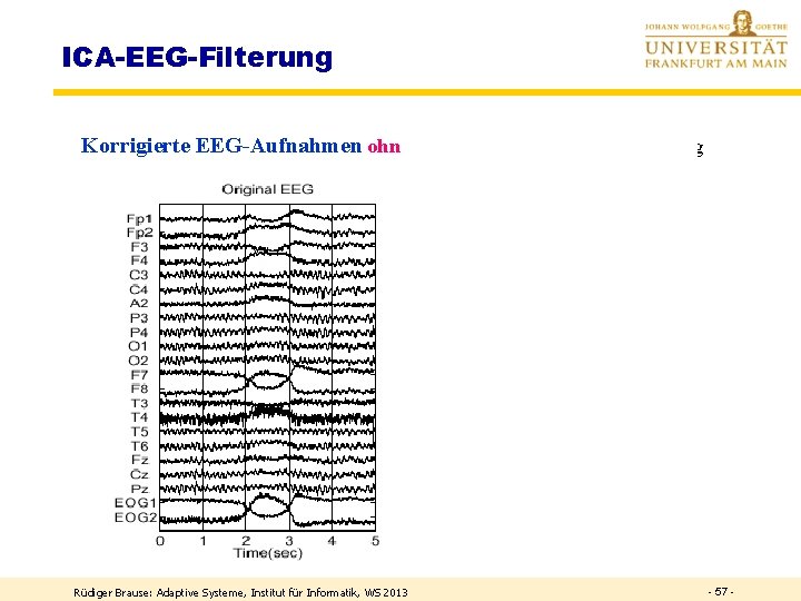 ICA-EEG-Filterung Korrigierte EEG-Aufnahmen ohne 5 ICA-Muskelaktivitäten, Mischung Rüdiger Brause: Adaptive Systeme, Institut für Informatik,