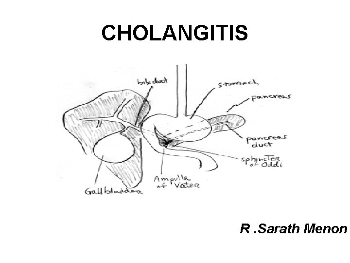 CHOLANGITIS R. Sarath Menon 