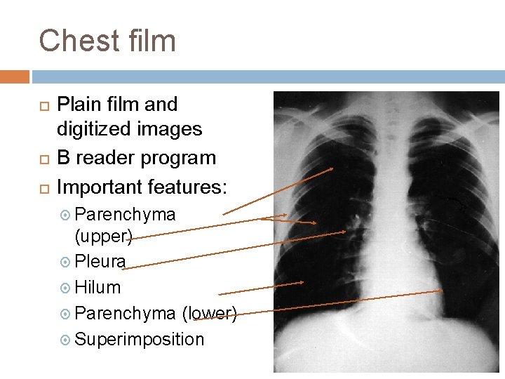 Chest film Plain film and digitized images B reader program Important features: Parenchyma (upper)