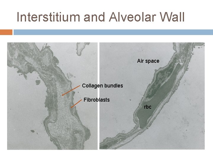 Interstitium and Alveolar Wall Air space Collagen bundles Fibroblasts rbc 