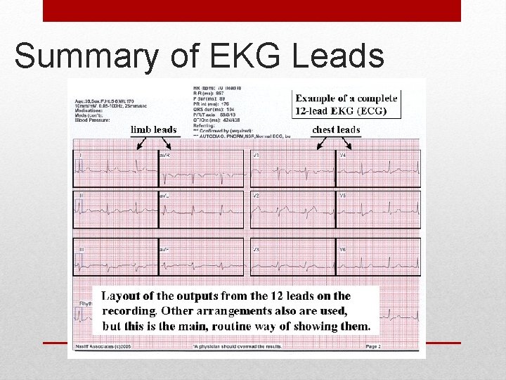 Summary of EKG Leads 