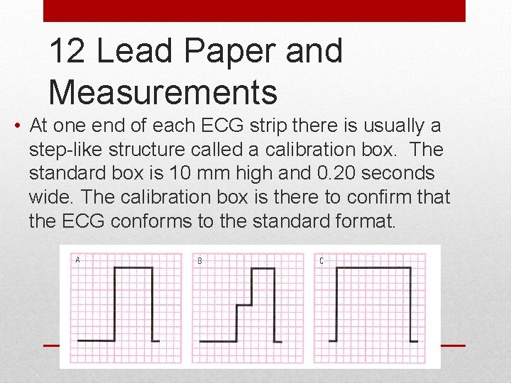 12 Lead Paper and Measurements • At one end of each ECG strip there