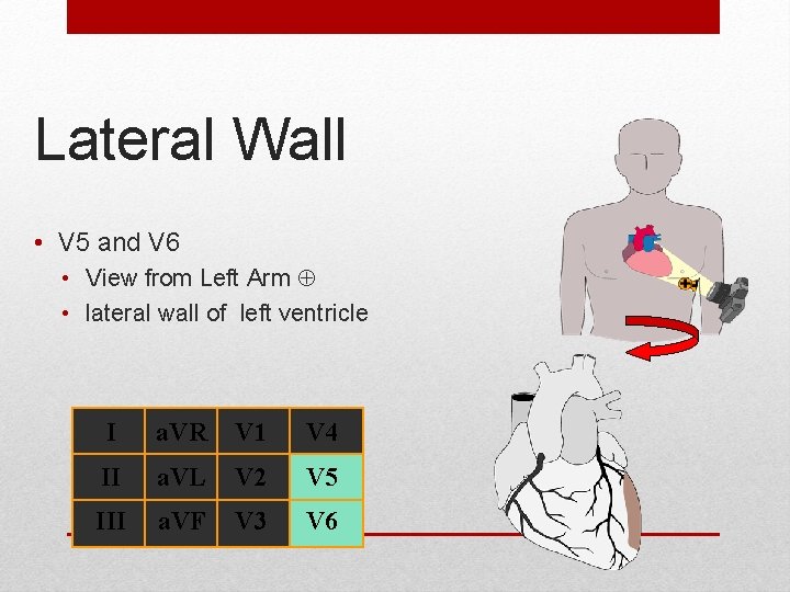 Lateral Wall • V 5 and V 6 • View from Left Arm •