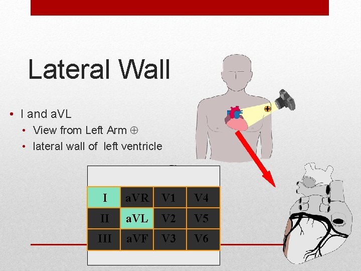 Lateral Wall • I and a. VL • View from Left Arm • lateral