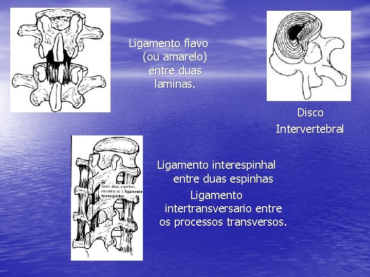 Ligamento flavo (ou amarelo) entre duas laminas. Disco Intervertebral Ligamento interespinhal entre duas espinhas