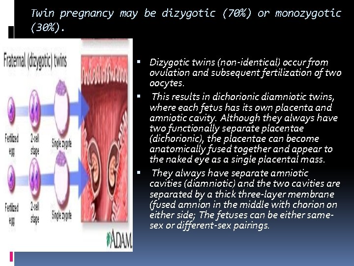Twin pregnancy may be dizygotic (70%) or monozygotic (30%). Dizygotic twins (non‐identical) occur from Twin pregnancy may be dizygotic (70%) or monozygotic (30%). Dizygotic twins (non‐identical) occur from