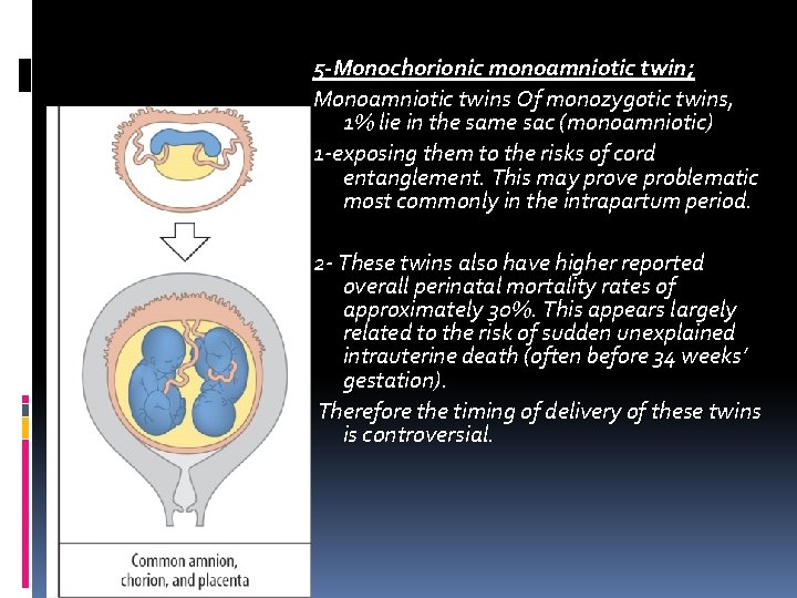 5 -Monochorionic monoamniotic twin; Monoamniotic twins Of monozygotic twins, 1% lie in the same 5 -Monochorionic monoamniotic twin; Monoamniotic twins Of monozygotic twins, 1% lie in the same