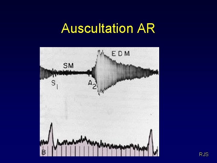 Auscultation AR RJS 