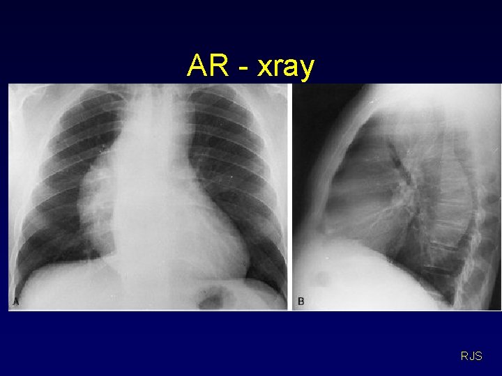 AR - xray RJS 