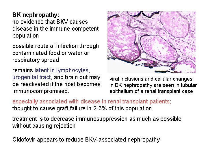 BK nephropathy: no evidence that BKV causes disease in the immune competent population possible