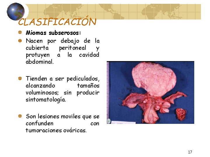 CLASIFICACIÓN Miomas subserosos: Nacen por debajo de la cubierta peritoneal y protuyen a la