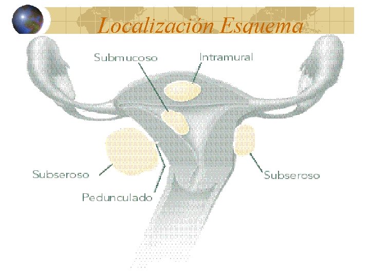 Localización Esquema 