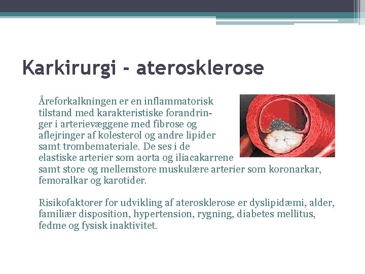 Karkirurgi - aterosklerose Åreforkalkningen er en inflammatorisk tilstand med karakteristiske forandringer i arterievæggene med