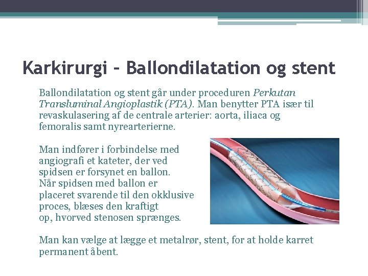 Karkirurgi – Ballondilatation og stent går under proceduren Perkutan Transluminal Angioplastik (PTA). Man benytter