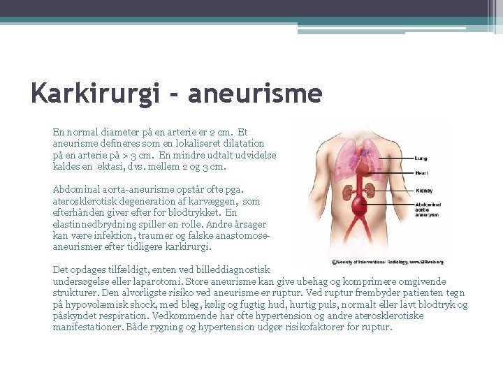 Karkirurgi - aneurisme En normal diameter på en arterie er 2 cm. Et aneurisme