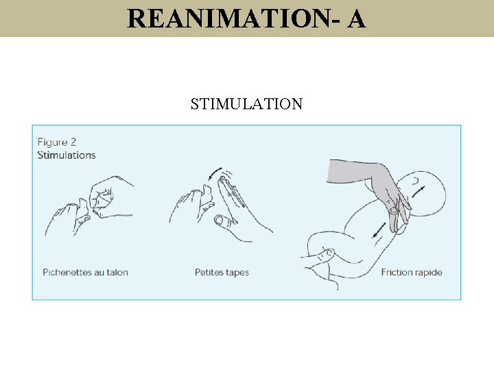 REANIMATION- A STIMULATION 