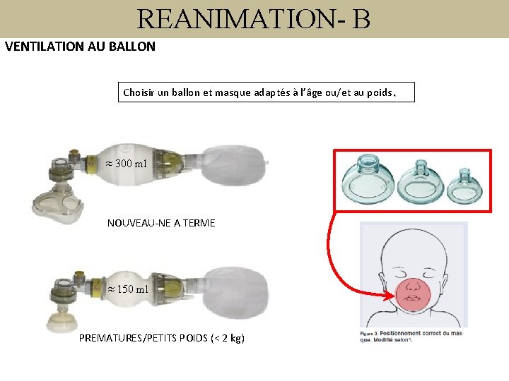 REANIMATION- B VENTILATION AU BALLON Choisir un ballon et masque adaptés à l’âge ou/et