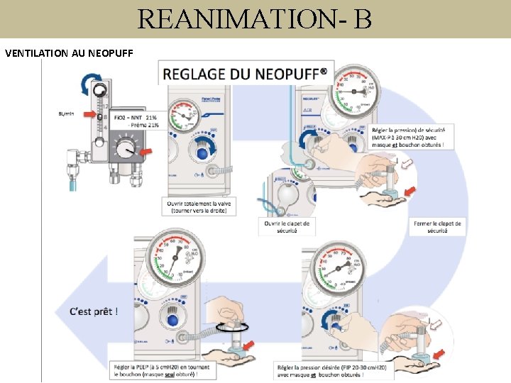 REANIMATION- B VENTILATION AU NEOPUFF 