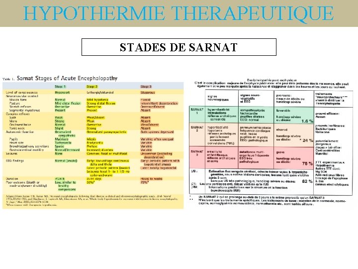 HYPOTHERMIE THERAPEUTIQUE STADES DE SARNAT 