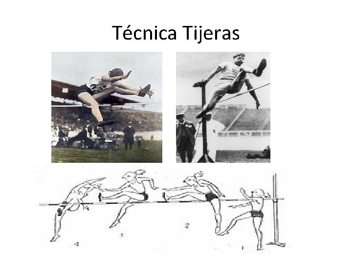 Técnica Tijeras 